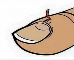 This Hurts More Than A Breakup