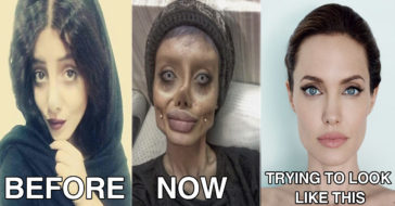 This Iranian Teen Undergoes 50+ Surgeries In Hope To Look Like Angelina Jolie