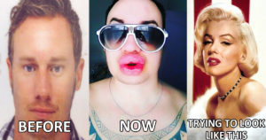 Man Pays Thousands & Undergoes 25+ Surgeries In Hope To Look Like Marilyn Monroe