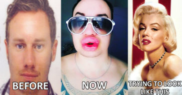 Man Pays Thousands & Undergoes 25+ Surgeries In Hope To Look Like Marilyn Monroe