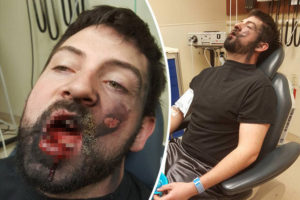 Vaping Causes Cancer, Proved By A New E-Cigarette Research