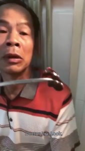 Doctor In China Removes A Huge Leech That's Alive From Patient's Nostril
