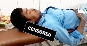 Indian Doctors Suspended After Patient's Amputated Leg Is Used As A Pillow After Surgery