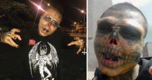 This Man Had His Nose Cut Off And Ears Removed To Look Like A Skull