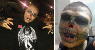This Man Had His Nose Cut Off And Ears Removed To Look Like A Skull