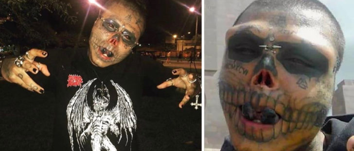 This Man Had His Nose Cut Off And Ears Removed To Look Like A Skull