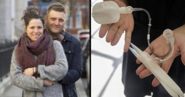 Man Born Without Penis Finally Loses His Virginity At 45 After Getting A Bionic One