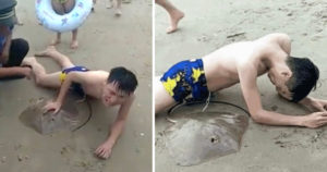 This Man Got His Penis Stung By A Stingray While Swimming In The Sea