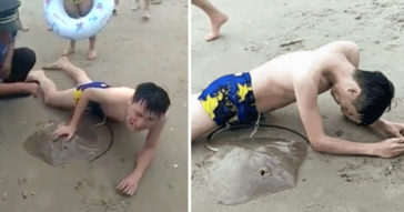 This Man Got His Penis Stung By A Stingray While Swimming In The Sea