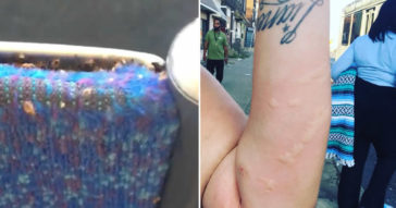 This Woman Discovers Thousands Of Bedbugs Crawling On The Bus Seat