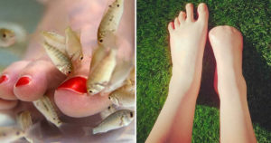 This Woman Had 5 Toes Amputated After Getting An Infection From Using Fish Spas
