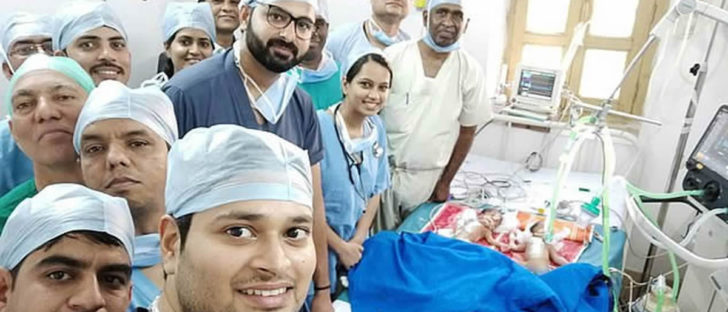 Doctors In India Separate Conjoined Twins For Free Because Parents Couldn’t Pay