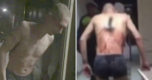 Man With Knife In Back Walks Out Of Hospital For Cigarette Under -10°C Temperature