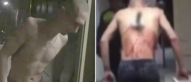 Man With Knife In Back Walks Out Of Hospital For Cigarette Under -10°C Temperature