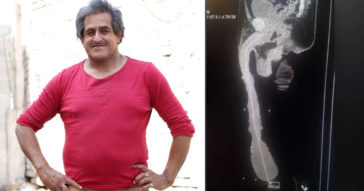 Man With World's Longest Penis Exposed As Average By Doctor