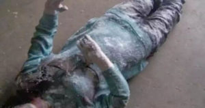 Woman Found Frozen Solid Makes An Incredible Full Recovery